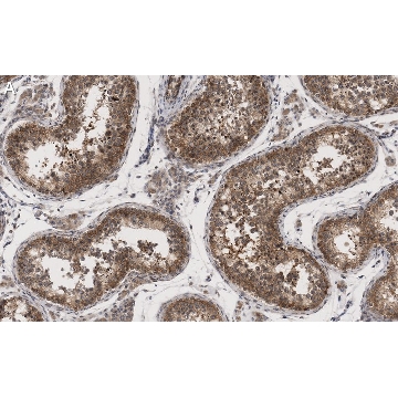 Anti-METTL7A Antibody, clone 1O8 ZooMAb® Rabbit Monoclonal，25UL，ZRB1185-25UL，Sigma