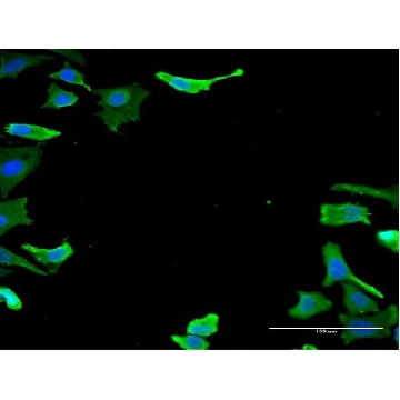 Monoclonal Anti-TUBA1B antibody produced in mouse，100UG，SAB1404816-100UG，Sigma