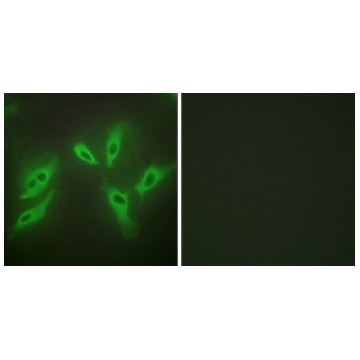 Anti-TUSC3 antibody produced in rabbit，100UG，SAB4503183-100UG，Sigma