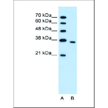Anti-PRPS2 antibody produced in rabbit，100UL，SAB2107995-100UL，Sigma
