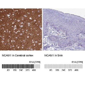 抗-NCAM1 兔抗，100UL，HPA039835-100UL，Sigma