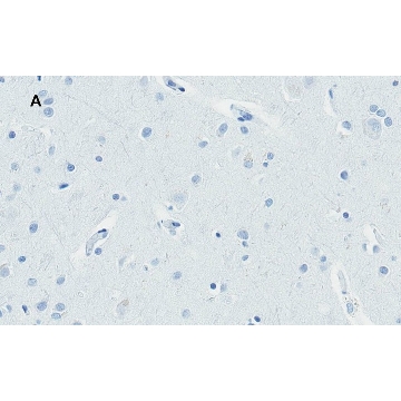 Anti-Huntingtin Protein Antibody, clone 1M11, ZooMAb® Rabbit Monoclonal，4X25UL，ZRB1102-4X25UL，Sigma