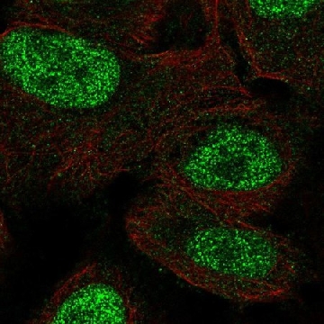 Anti-MSX1 antibody produced in rabbit，100UL，HPA063895-100UL，Sigma