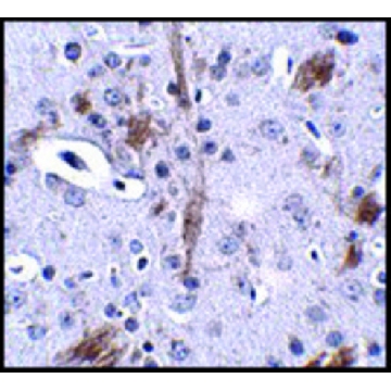 Anti-TTBK1 antibody produced in rabbit，100UG，SAB3500002-100UG，Sigma