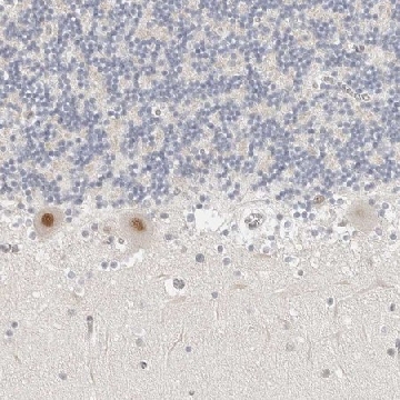 Anti-TSEN2 antibody produced in rabbit，100UL，HPA027120-100UL，Sigma