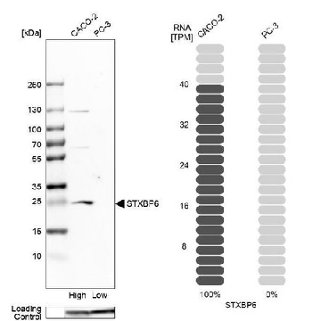 Anti-STXBP6 antibody produced in rabbit，100UL，HPA003552-100UL，Sigma