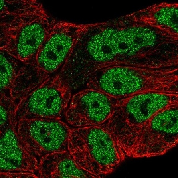 Anti-ABCA6 antibody produced in rabbit，100UL，HPA067180-100UL，Sigma