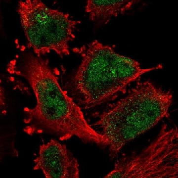 Anti-ATR antibody produced in rabbit，100UL，HPA054320-100UL，Sigma