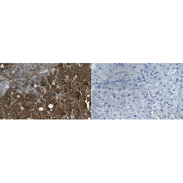 Anti-Ferritin Heavy Chain Antibody, clone 1J22 ZooMAb® Rabbit Monoclonal，25UL，ZRB2695-25UL，Sigma
