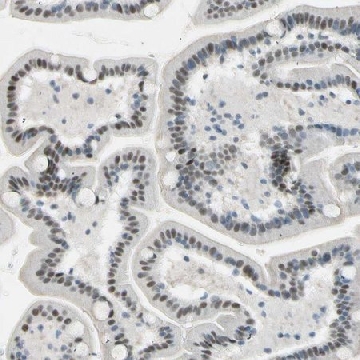 Anti-RNF43 antibody produced in rabbit，100UL，HPA008079-100UL，Sigma