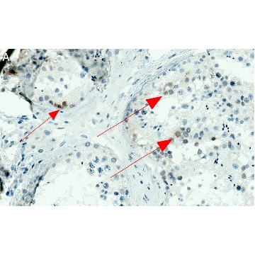 Anti-NY-ESO-1 Antibody, clone 1J11 ZooMAb® Rabbit Monoclonal，25UL，ZRB1540-25UL，Sigma