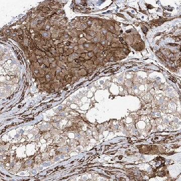 Anti-UBTD1 antibody produced in rabbit，100UL，HPA034825-100UL，Sigma