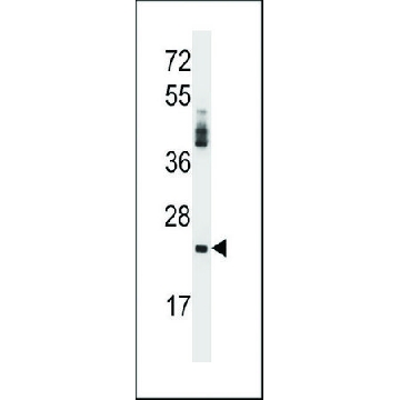 ANTI-PRSS2 (CENTER) antibody produced in rabbit，400UL，SAB1307060-400UL，Sigma