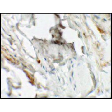 Anti-HHATL antibody produced in rabbit，100UG，SAB3500714-100UG，Sigma