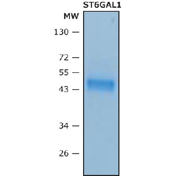 Beta-galactoside alpha-2,6-sialyltransferase 1，10UG，SAE0090-10UG，Sigma