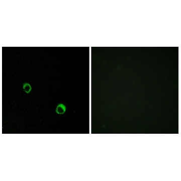 Anti-CAR14 antibody produced in rabbit，100UG，SAB4503140-100UG，Sigma