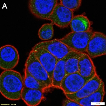 Anti-MMP-7 Antibody, clone 2B3 ZooMAb® Rabbit Monoclonal，25UL，ZRB2059-25UL，Sigma