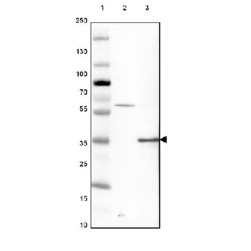 Anti-GATAD1 antibody produced in rabbit，100UL，HPA006105-100UL，Sigma