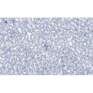 Anti-Calbindin D-28K clone 1A11 Antibody, ZooMAb® Rabbit Monoclonal，4X25UL，ZRB1778-4X25UL，Sigma