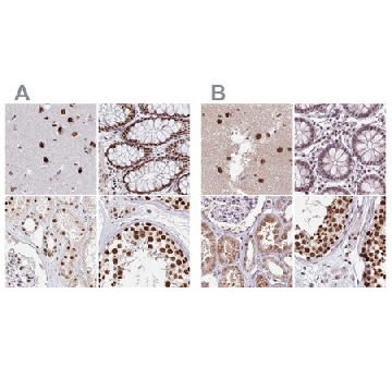 Anti-AKAP8L antibody produced in rabbit，100UL，HPA042485-100UL，Sigma