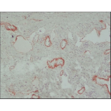 Anti-Tenascin antibody, Mouse monoclonal，100UL，SAB4200782-100UL，Sigma