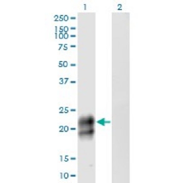 Monoclonal Anti-TNFRSF17 antibody produced in mouse，100UG，SAB1403600-100UG，Sigma