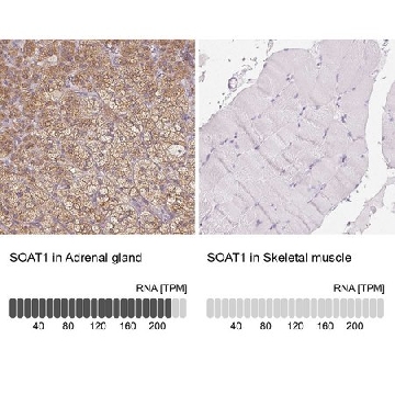 Anti-SOAT1 antibody produced in rabbit，100UL，HPA047171-100UL，Sigma