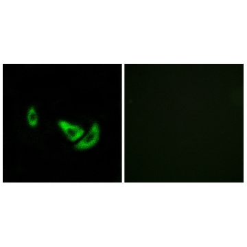 Anti-DCT antibody produced in rabbit，100UG，SAB4500626-100UG，Sigma
