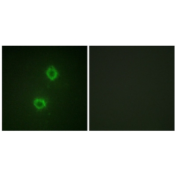 Anti-FGFR1 antibody produced in rabbit，100UG，SAB4500886-100UG，Sigma