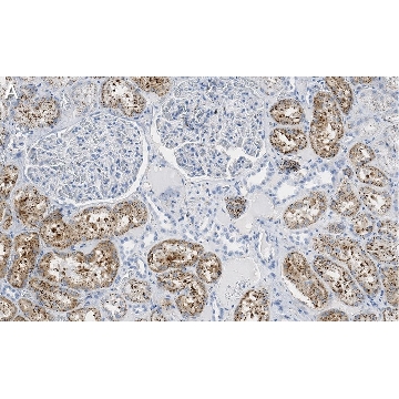 Anti-Cathepsin L1 Antibody, clone 1G2 ZooMAb® Rabbit Monoclonal，25UL，ZRB1636-25UL，Sigma