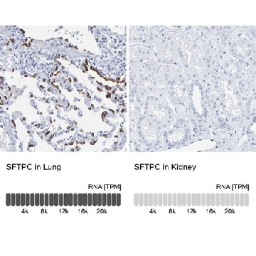 抗-SFTPC 兔抗，100UL，HPA010928-100UL，Sigma