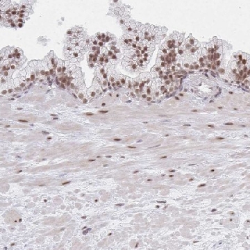 Anti-MBNL1 antibody produced in rabbit，100UL，HPA035098-100UL，Sigma