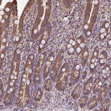 Anti-MAN1A1 antibody produced in rabbit，100UL，HPA063561-100UL，Sigma