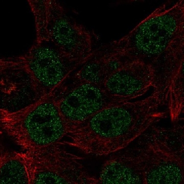 Anti-HOXB8 antibody produced in rabbit，100UL，HPA075905-100UL，Sigma