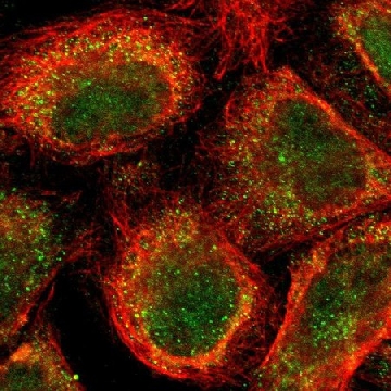 Anti-MLLT3 antibody produced in rabbit，100UL，HPA001824-100UL，Sigma