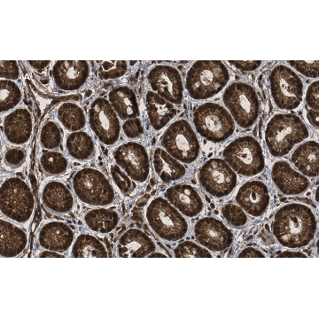 Anti-p44 MAPK (ERK1) Antibody, clone 13F10, ZooMAb® Rabbit Monoclonal，25UL，ZRB06182-25UL，Sigma