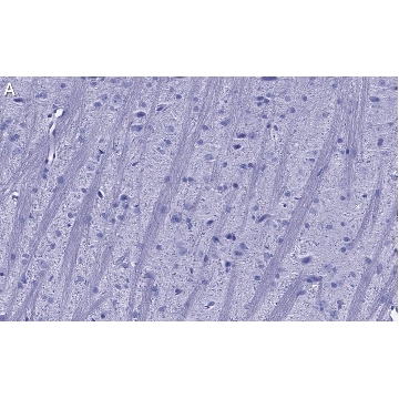 Anti-Synaptophysin Antibody, clone 1G7, ZooMAb® Rabbit Monoclonal，25UL，ZRB1317-25UL，Sigma