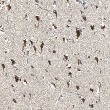 Anti-KEAP1 antibody produced in rabbit，100UL，HPA005558-100UL，Sigma