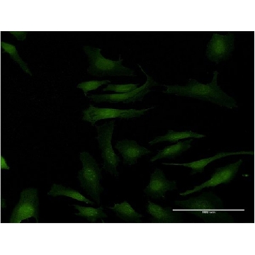 ANTI-MAPKAPK2 antibody produced in mouse，100UG，SAB1412291-100UG，Sigma