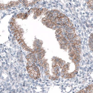 Anti-TMEM30A antibody produced in rabbit，100UL，HPA014561-100UL，Sigma