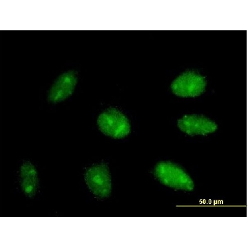 Anti-EXOSC3 antibody produced in mouse，50UG，SAB1407430-50UG，Sigma