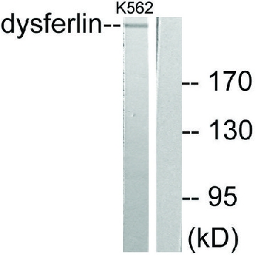 Anti-Dysferlin, antibody produced in rabbit，100UG，SAB4503260-100UG，Sigma