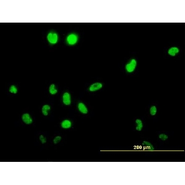 Monoclonal Anti-TSSK1, (C-terminal) antibody produced in mouse，100UG，SAB1405300-100UG，Sigma