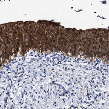 Anti-PRPF4B antibody produced in rabbit，100UL，HPA020638-100UL，Sigma