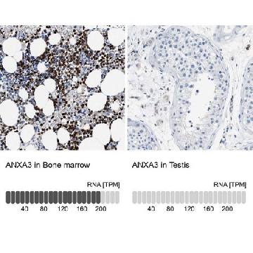 Anti-ANXA3 antibody produced in rabbit，100UL，HPA013398-100UL，Sigma