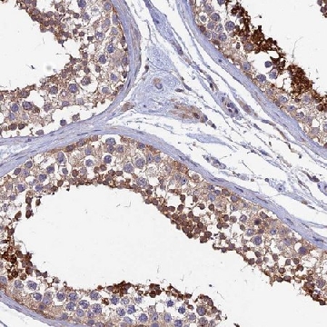 Anti-KIAA1211 antibody produced in rabbit，100UL，HPA043249-100UL，Sigma