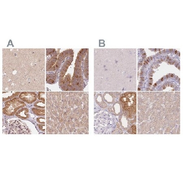 Anti-WDR54 antibody produced in rabbit，100UL，HPA043257-100UL，Sigma