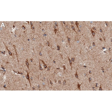 Anti-β-NGF Antibody, clone 1F18 ZooMAb® Rabbit Monoclonal，4X25UL，ZRB1392-4X25UL，Sigma