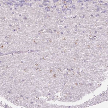 Anti-FOCAD antibody produced in rabbit，100UL，HPA055015-100UL，Sigma