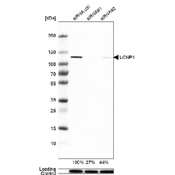 Anti-LONP1 antibody produced in rabbit，100UL，HPA002192-100UL，Sigma